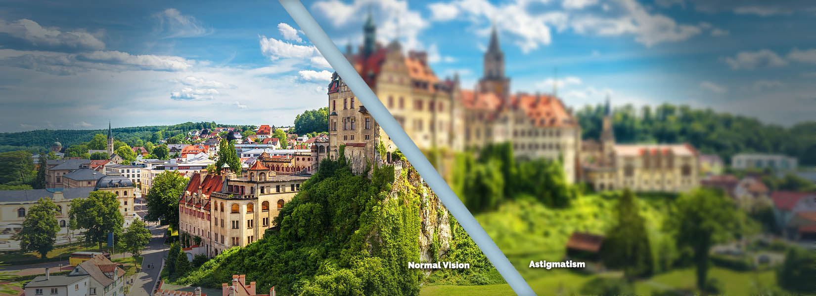 Astigmatism Treatment in The Landings