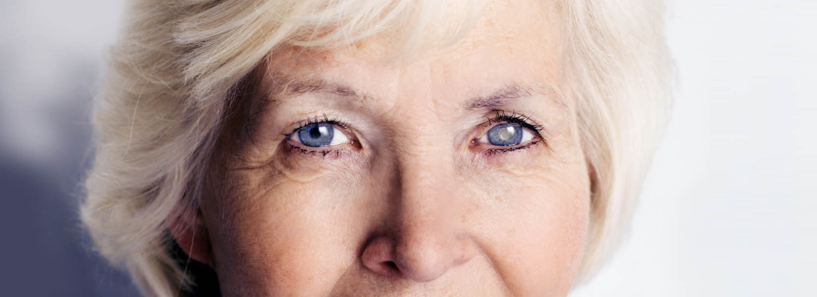 Cataract Surgery in The Landings